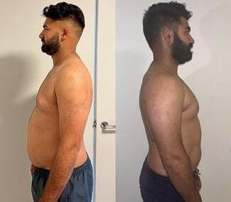 before and after collageszaheer-min